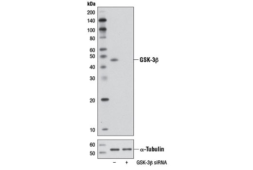  Image 1: SignalSilence® GSK-3β siRNA I (Mouse Specific)