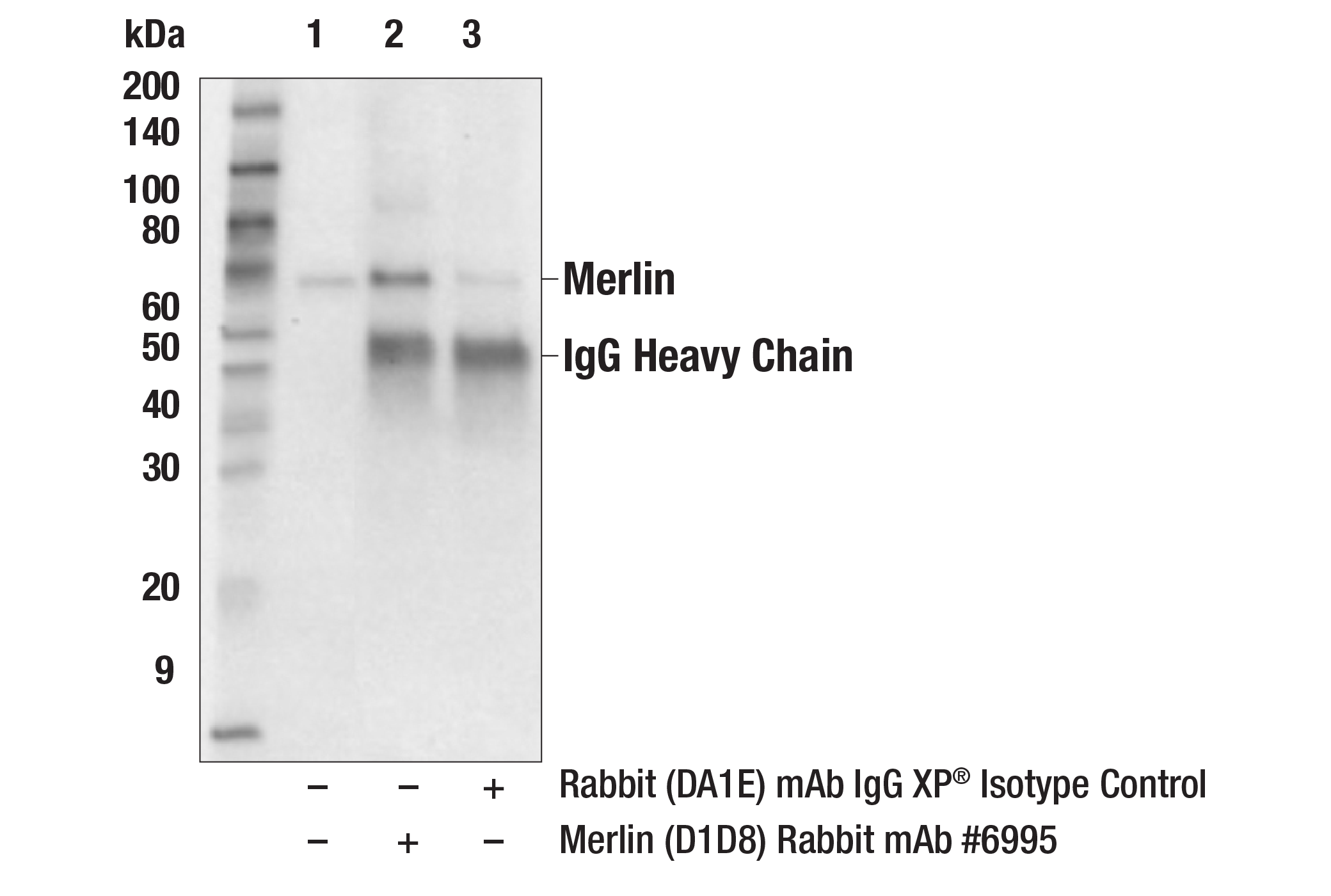 Immunoprecipitation Image 1: Merlin (D1D8) Rabbit Monoclonal Antibody
