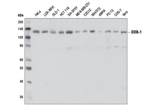  Image 6: CRL4/CRBN Targeted Protein Degradation Complex Antibody Sampler Kit