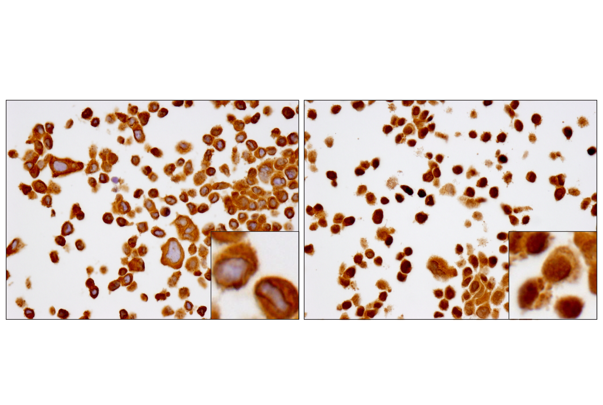 Immunohistochemistry Image 2: NF-κB p65 (D14E12) XP® Rabbit mAb (BSA and Azide Free)