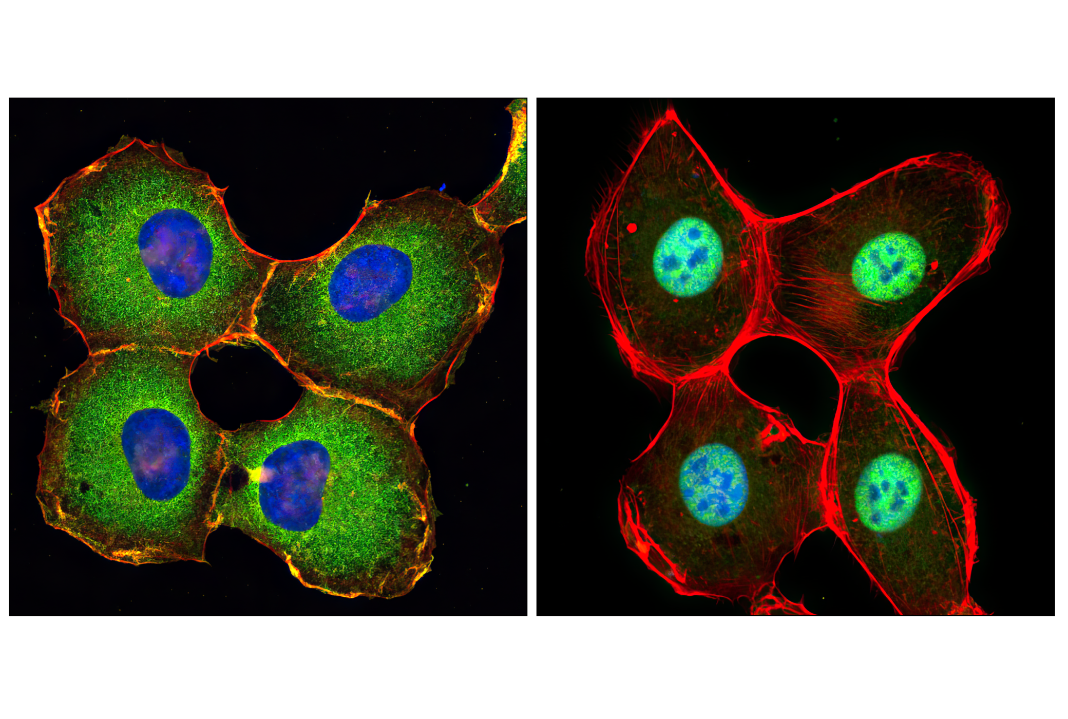 Immunofluorescence Image 1: NF-κB p65 (D14E12) XP® Rabbit mAb (BSA and Azide Free)