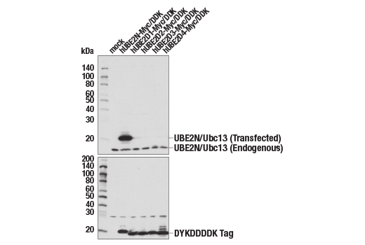  Image 5: Ubiquitin Activation (E1, E2 Enzymes) Antibody Sampler Kit