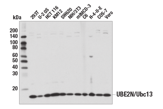  Image 10: Ubiquitin Activation (E1, E2 Enzymes) Antibody Sampler Kit
