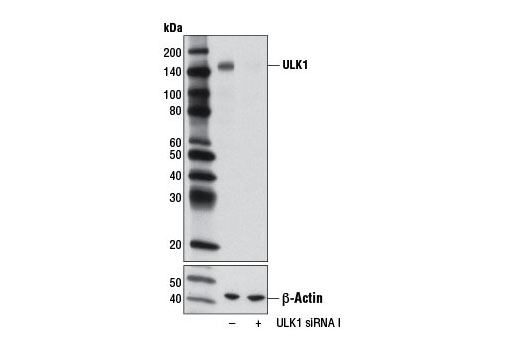  Image 1: SignalSilence® ULK1 siRNA I
