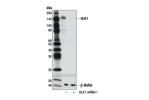  Image 2: SignalSilence® ULK1 siRNA I