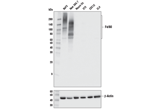  Image 10: Mouse Reactive M1 vs M2 Macrophage IHC Antibody Sampler Kit