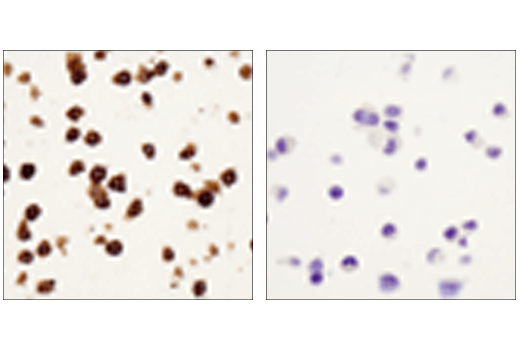  Image 34: Mouse Reactive M1 vs M2 Macrophage IHC Antibody Sampler Kit