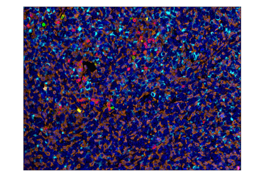  Image 43: Mouse Immune Cell Phenotyping IHC Antibody Sampler Kit