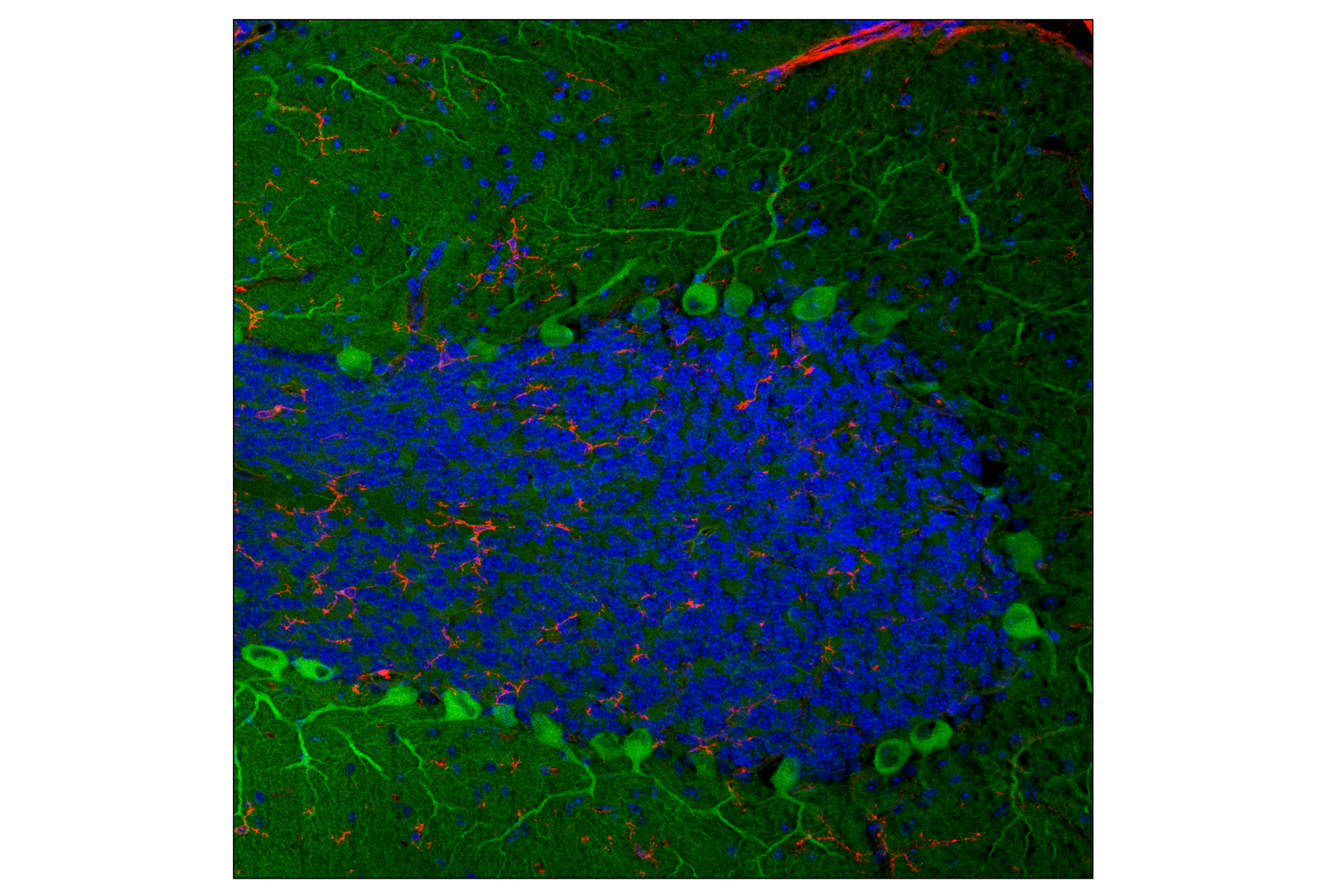 Immunofluorescence Image 1: PIP4K2C (E7P3S) Rabbit mAb (Alexa Fluor® 488 Conjugate)