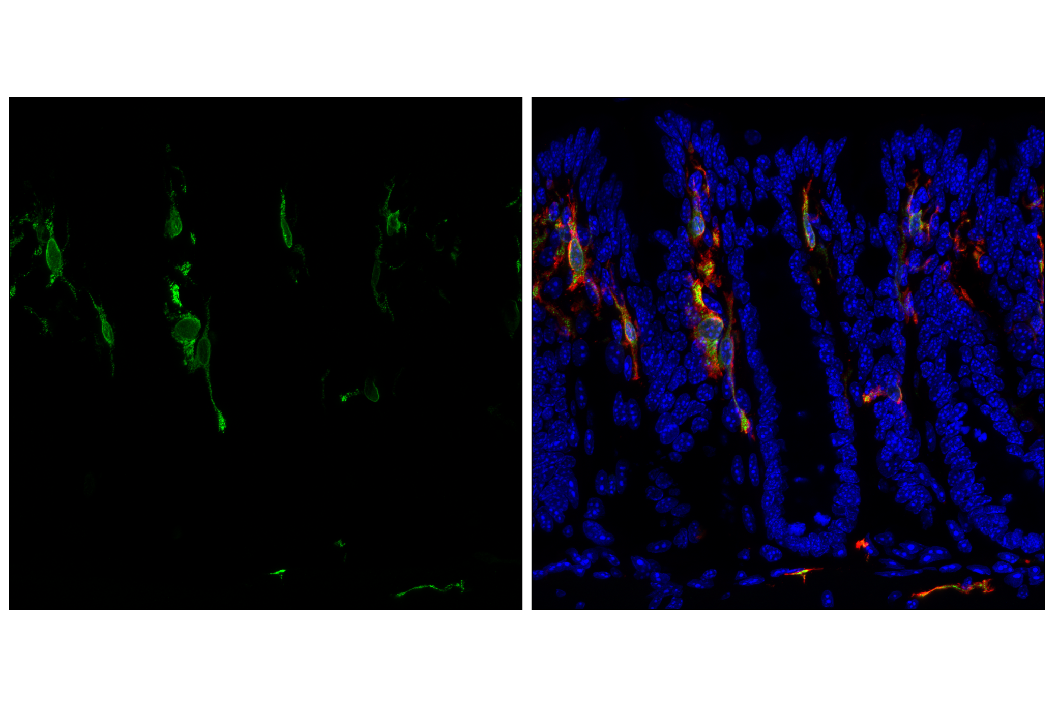 Immunofluorescence Image 4: CD74 (F6K1S) Rabbit mAb