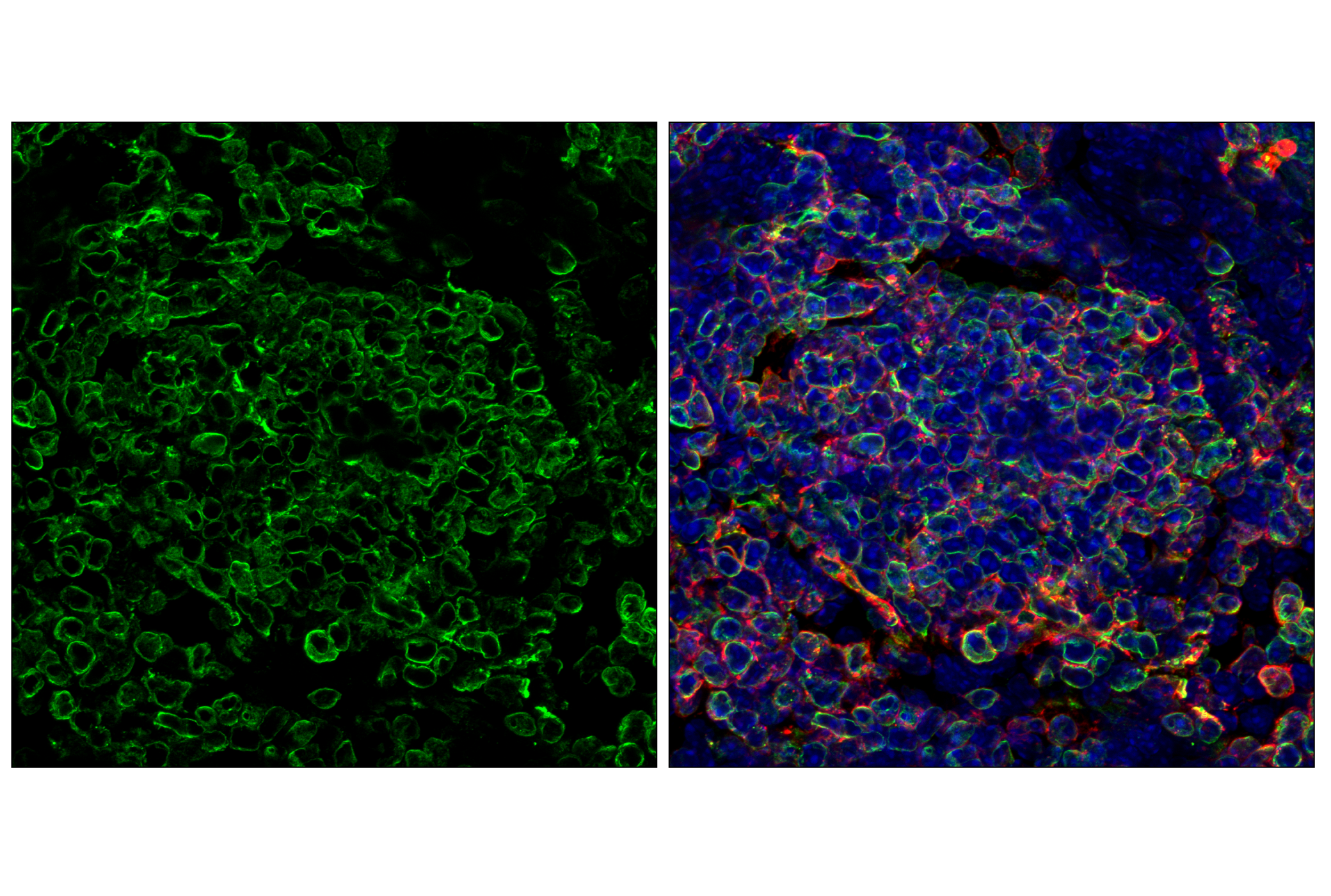 Immunofluorescence Image 3: CD74 (F6K1S) Rabbit mAb