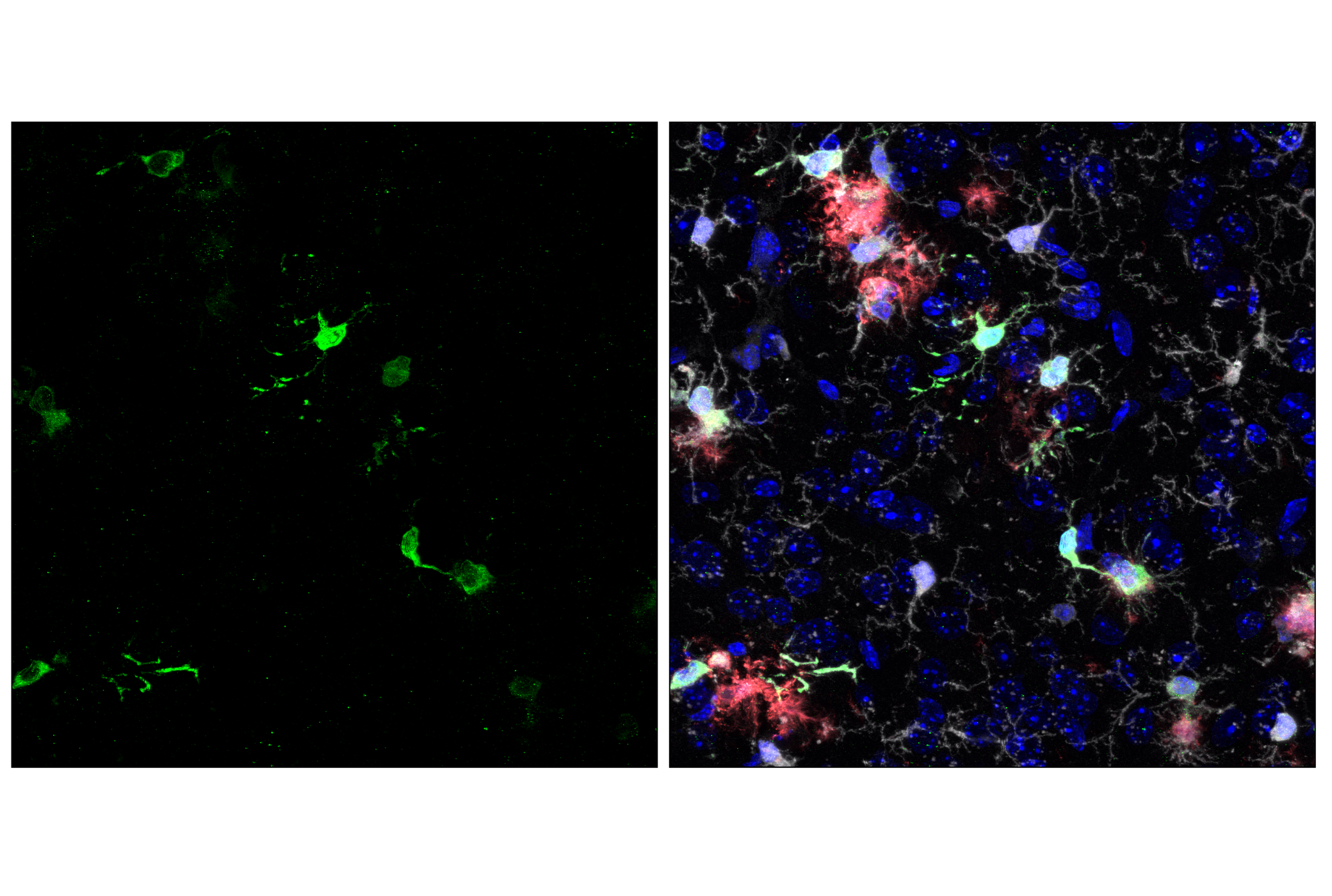 Immunofluorescence Image 1: CD74 (F6K1S) Rabbit mAb