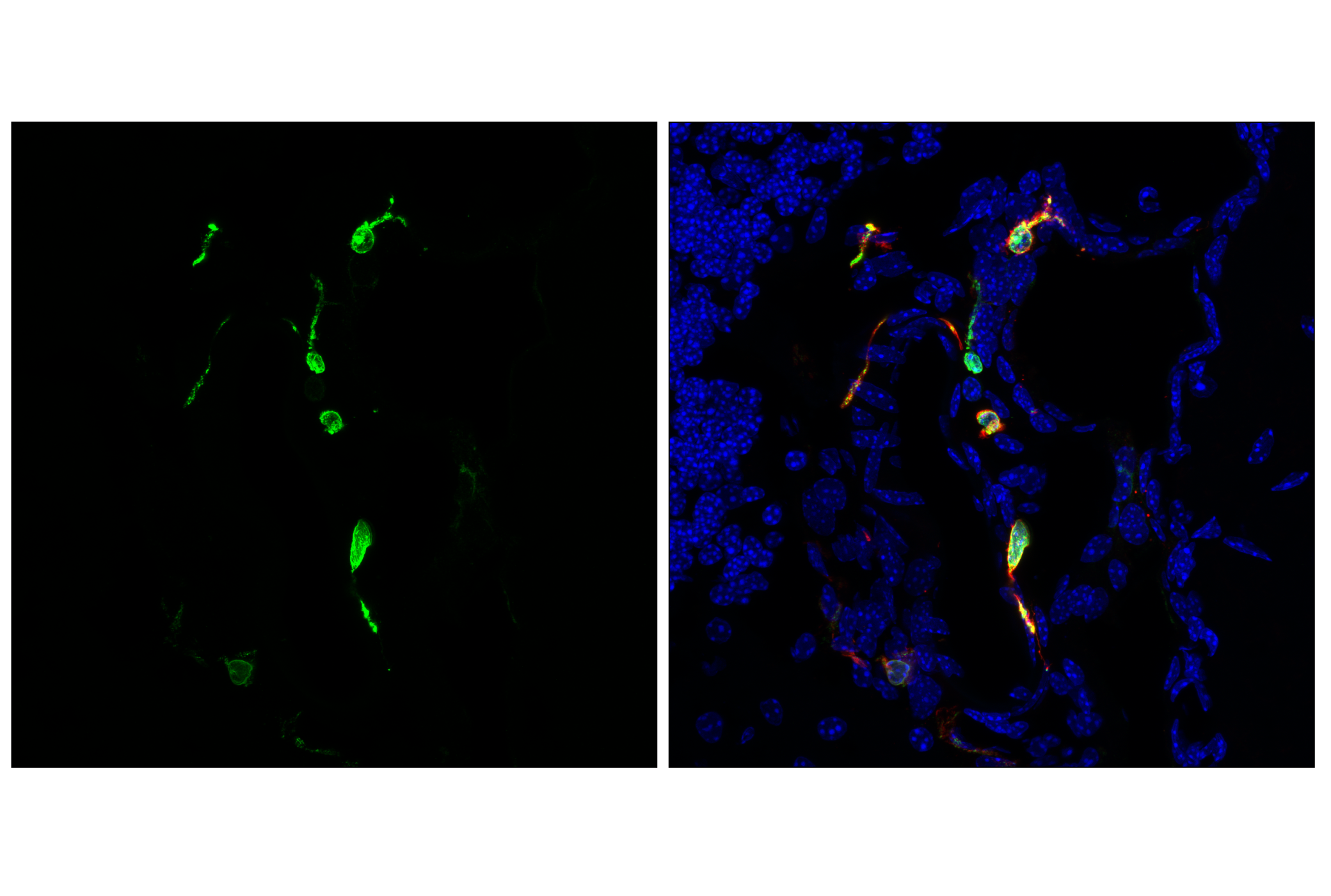 Immunofluorescence Image 2: CD74 (F6K1S) Rabbit mAb