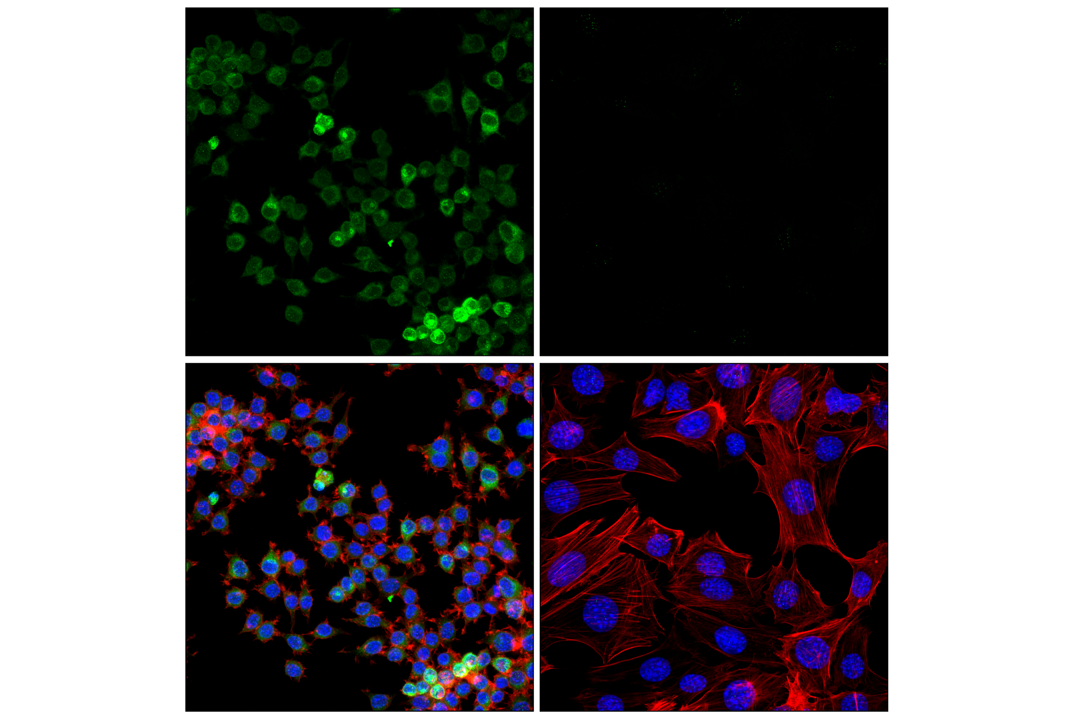 Immunofluorescence Image 5: CD74 (F6K1S) Rabbit mAb