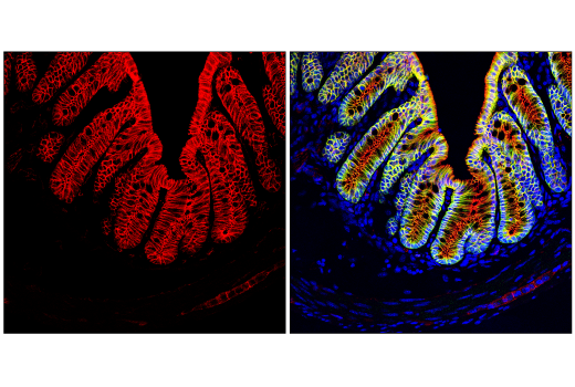 Immunofluorescence Image 1: β-Catenin (D10A8) XP® Rabbit mAb (Alexa Fluor® 594 Conjugate)