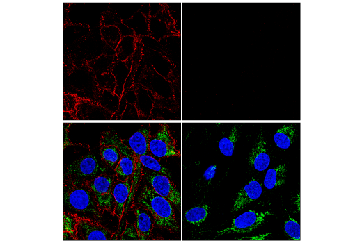 Immunofluorescence Image 2: β-Catenin (D10A8) XP® Rabbit mAb (Alexa Fluor® 594 Conjugate)