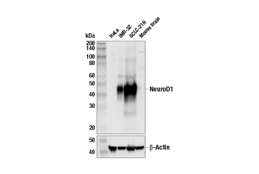 undefined Image 4: Immature Neuron Marker Antibody Sampler Kit