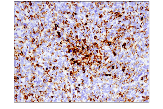Immunohistochemistry Image 1: CD45 (D3F8Q) Rabbit mAb