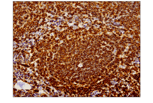 Immunohistochemistry Image 4: CD45 (D3F8Q) Rabbit mAb