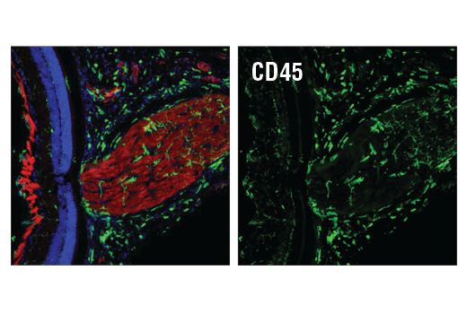 Immunofluorescence Image 1: CD45 (D3F8Q) Rabbit mAb