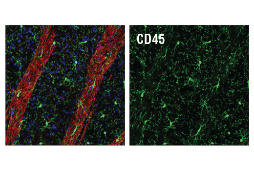 Immunofluorescence Image 2: CD45 (D3F8Q) Rabbit mAb