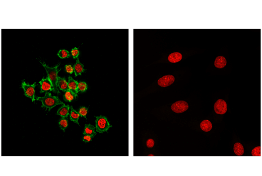 Immunofluorescence Image 4: CD45 (D3F8Q) Rabbit mAb