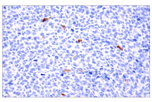 Immunohistochemistry Image 8: Tryptase (E7M2U) Rabbit mAb (BSA and Azide Free)