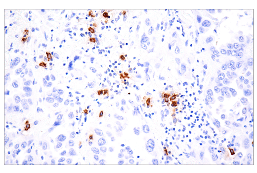 Immunohistochemistry Image 4: Tryptase (E7M2U) Rabbit mAb (BSA and Azide Free)