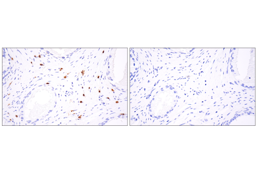 Immunohistochemistry Image 9: Tryptase (E7M2U) Rabbit mAb (BSA and Azide Free)