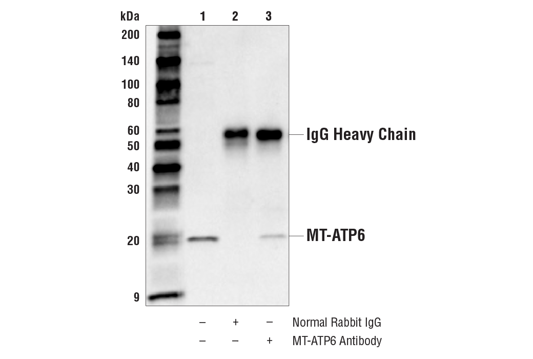 Immunoprecipitation Image 1: MT-ATP6 Antibody