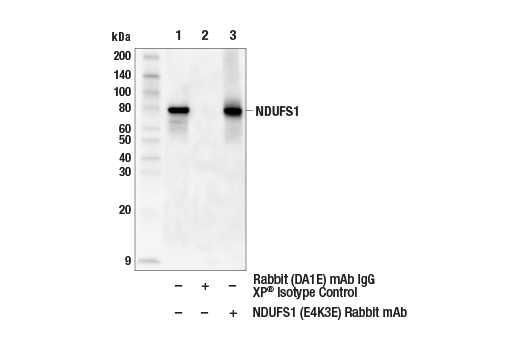 Immunoprecipitation Image 1: NDUFS1 (E4K3E) Rabbit mAb