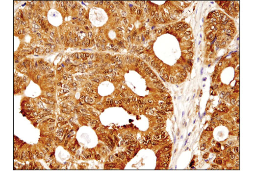 Immunohistochemistry Image 1: Galectin-3/LGALS3 (D4I2R) XP® Rabbit mAb (BSA and Azide Free)
