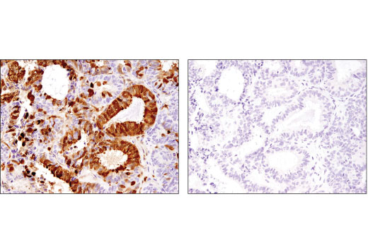 Immunohistochemistry Image 3: Galectin-3/LGALS3 (D4I2R) XP® Rabbit mAb (BSA and Azide Free)
