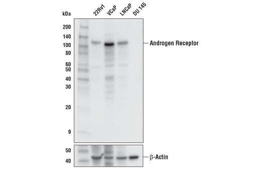 Western Blotting Image 1: Androgen Receptor (E3S4N) Rabbit mAb (Carboxy-terminal Antigen)