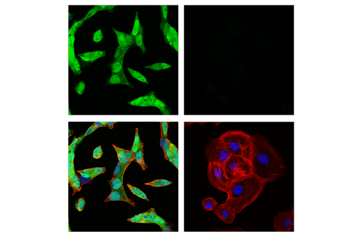 Immunofluorescence Image 1: Androgen Receptor (E3S4N) Rabbit mAb (Carboxy-terminal Antigen)