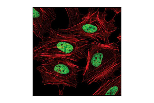 Immunofluorescence Image 1: Di-Methyl-Histone H3 (Lys4) (C64G9) Rabbit mAb (BSA and Azide Free)
