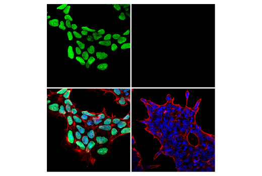 Immunofluorescence Image 1: Histone H3 (K9M Mutant Specific) (E2E9L) Rabbit mAb