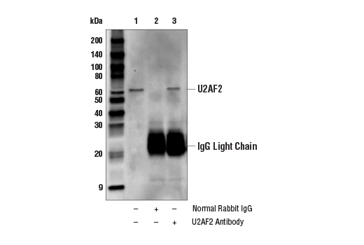 Immunoprecipitation Image 1: U2AF2 Antibody