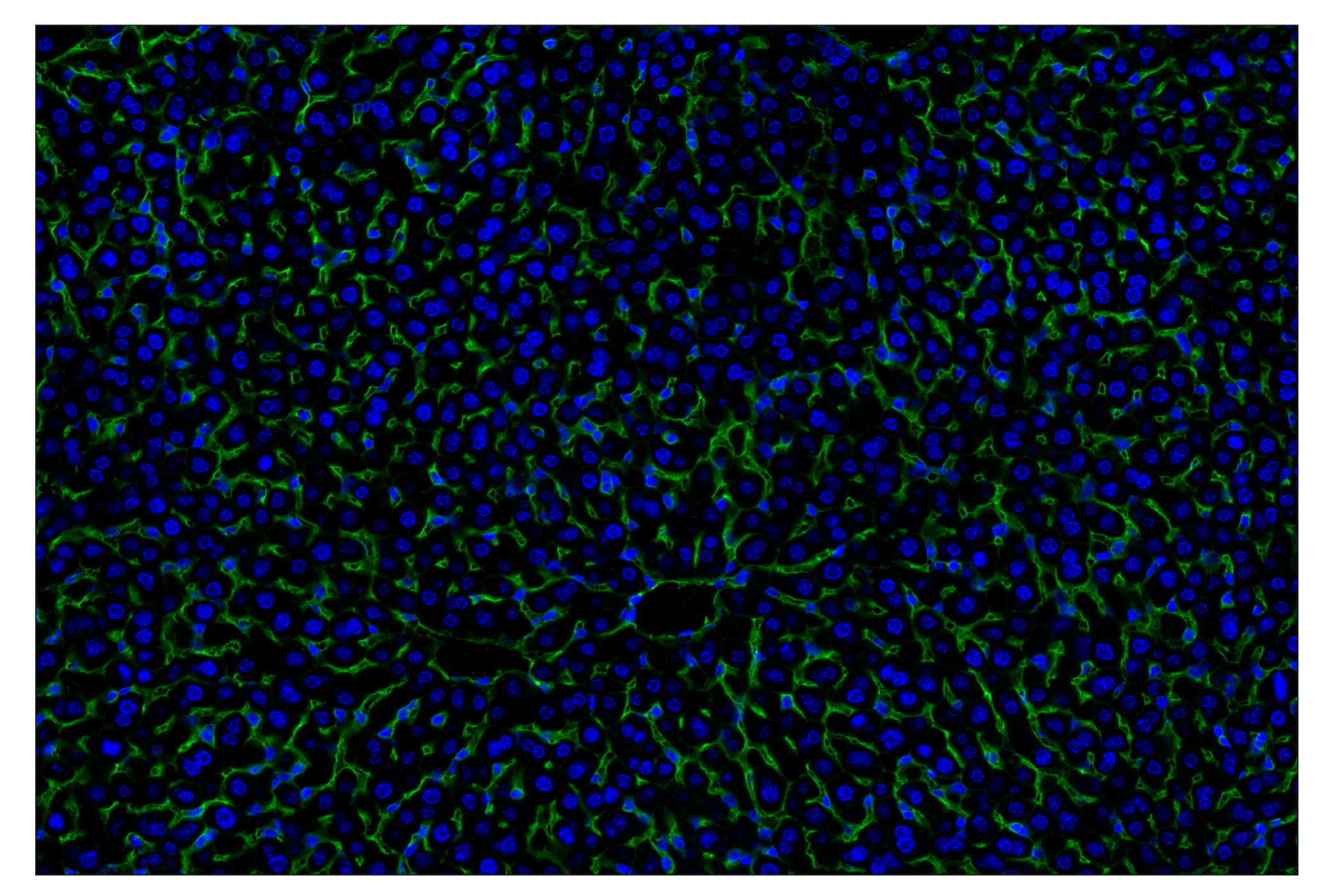 Immunohistochemistry Image 2: CD47 (E2V9V) Rabbit mAb (Alexa Fluor® 488 Conjugate)