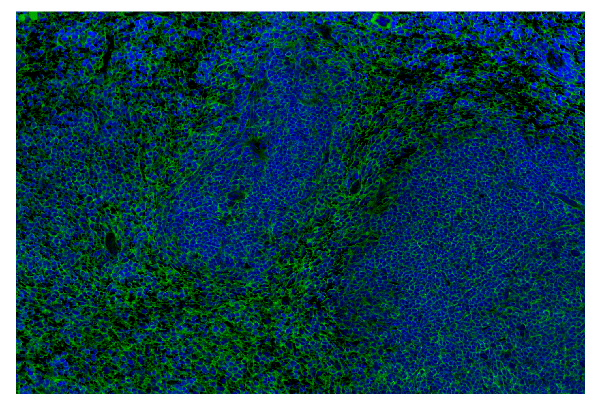 Immunohistochemistry Image 1: CD47 (E2V9V) Rabbit mAb (Alexa Fluor® 488 Conjugate)