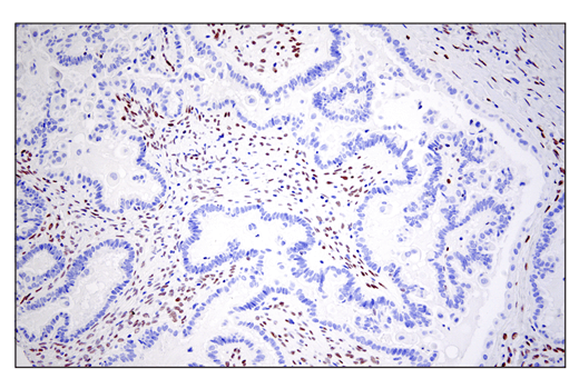 Immunohistochemistry Image 3: ZEB1 (E2G6Y) XP® Rabbit mAb