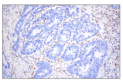  Image 37: Epithelial-Mesenchymal Transition (EMT) IF Antibody Sampler Kit