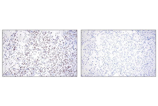  Image 53: Epithelial-Mesenchymal Transition (EMT) IF Antibody Sampler Kit
