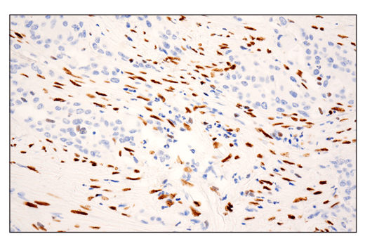  Image 29: Epithelial-Mesenchymal Transition (EMT) IF Antibody Sampler Kit