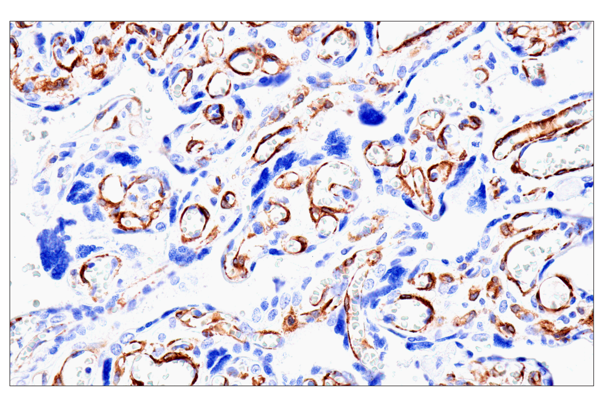 Immunohistochemistry Image 5: MYH11 (E4N8M) Rabbit Monoclonal Antibody (BSA and Azide Free)