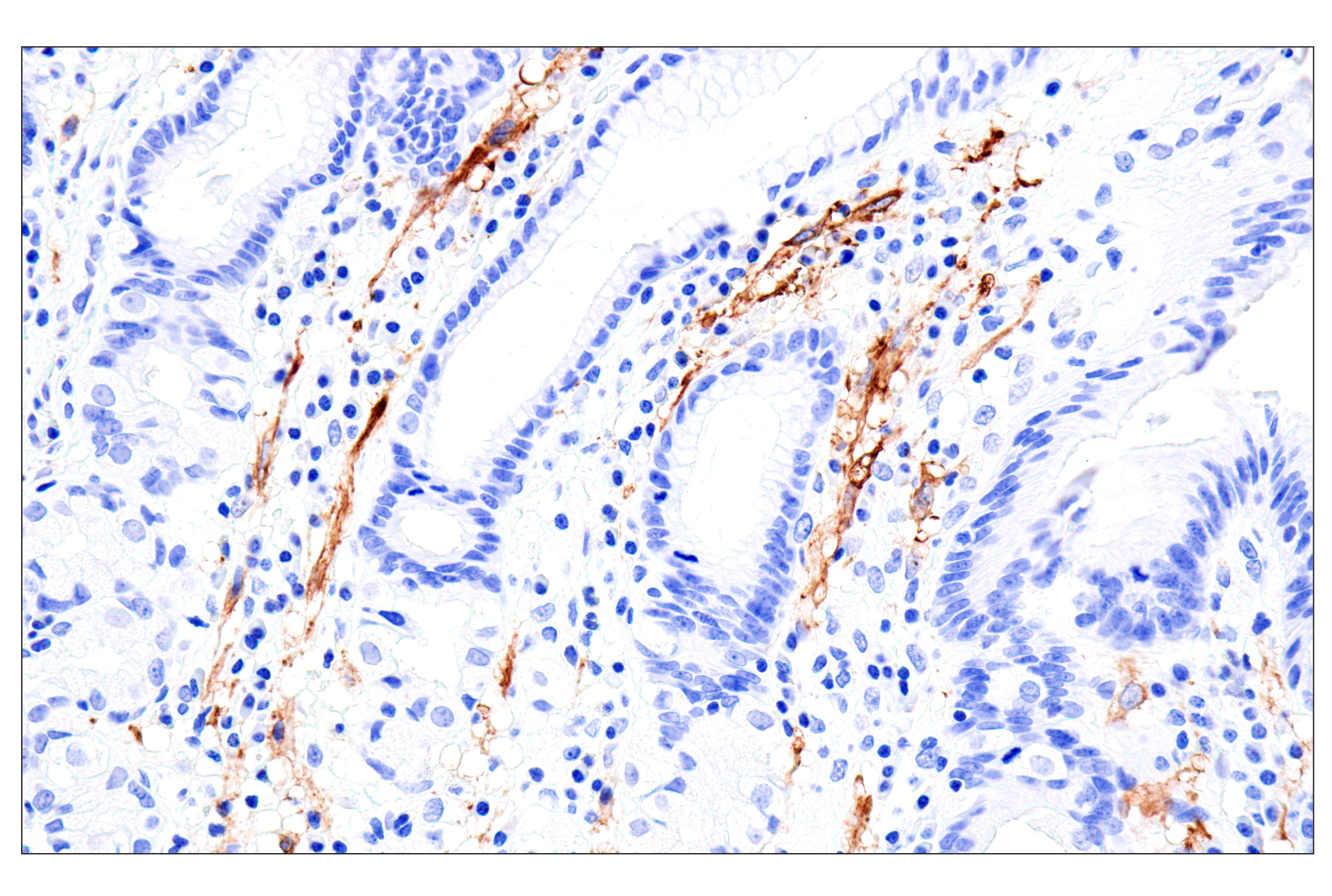 Immunohistochemistry Image 8: MYH11 (E4N8M) Rabbit Monoclonal Antibody (BSA and Azide Free)