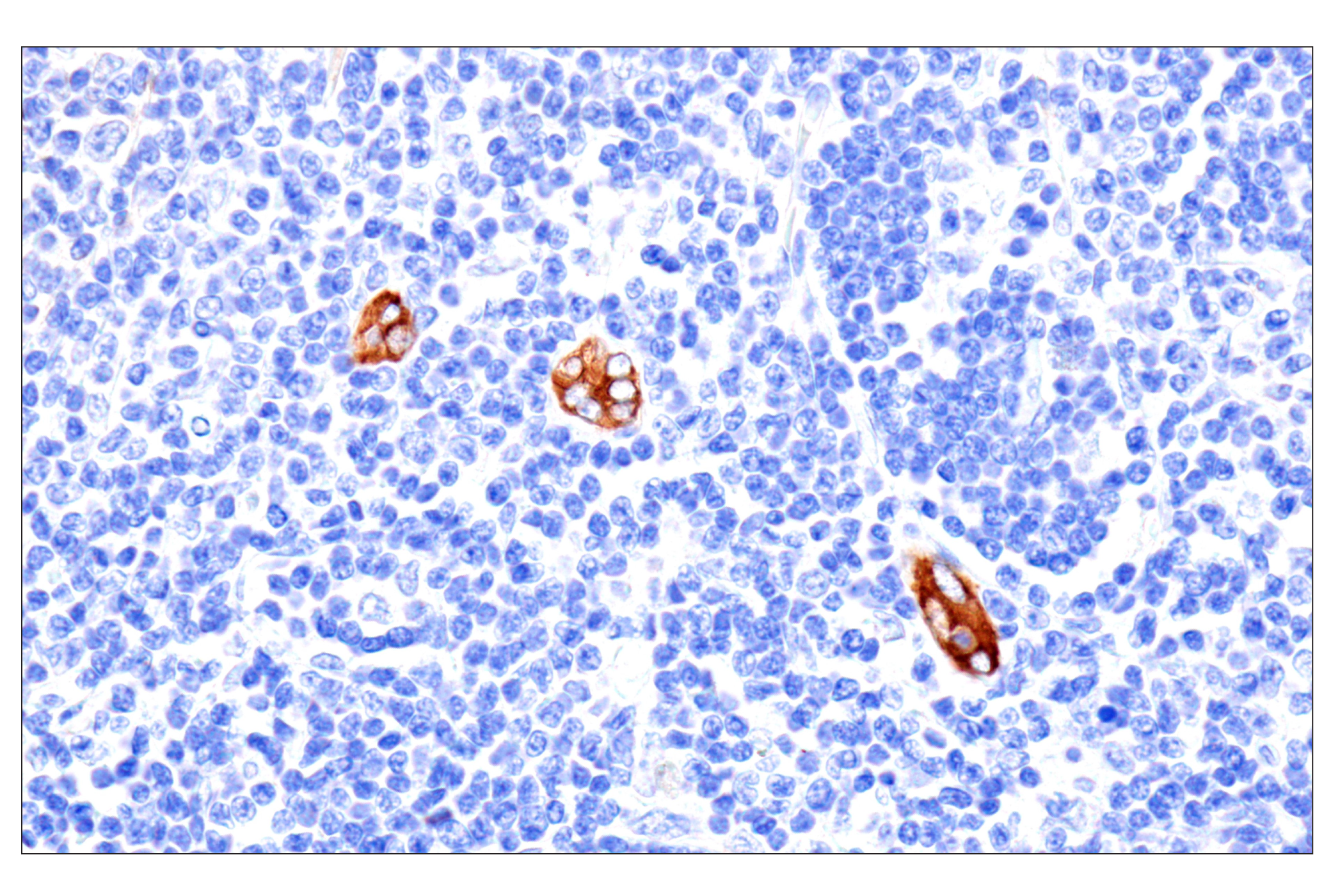 Immunohistochemistry Image 3: MYH11 (E4N8M) Rabbit Monoclonal Antibody (BSA and Azide Free)