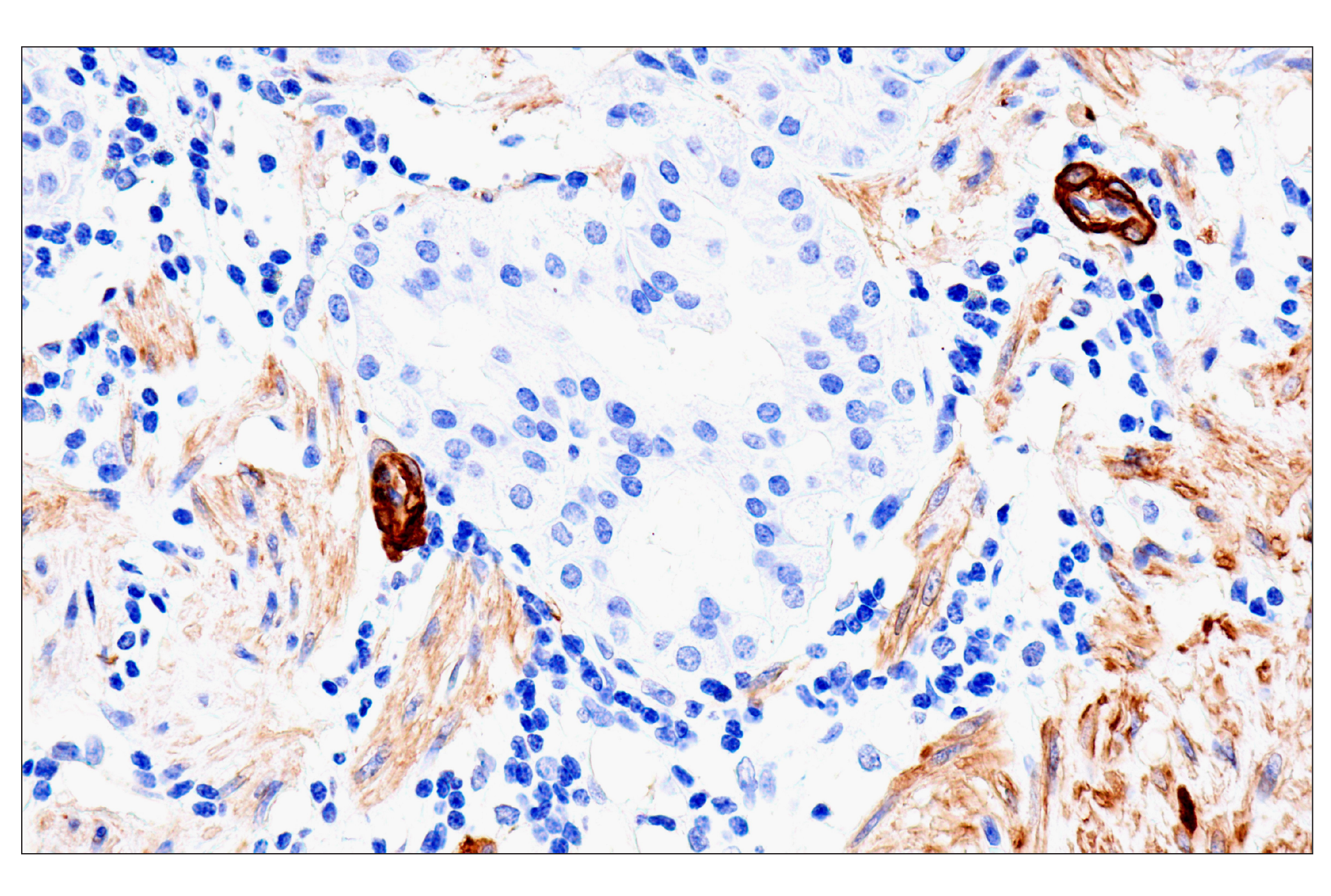 Immunohistochemistry Image 4: MYH11 (E4N8M) Rabbit Monoclonal Antibody (BSA and Azide Free)