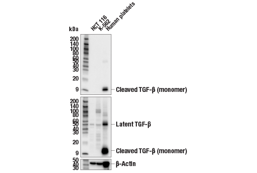 Western Blotting Image 1: Cleaved TGF-β1 (Ala279)/ TGF-β3 (Ala301) (E5L1D) Rabbit mAb
