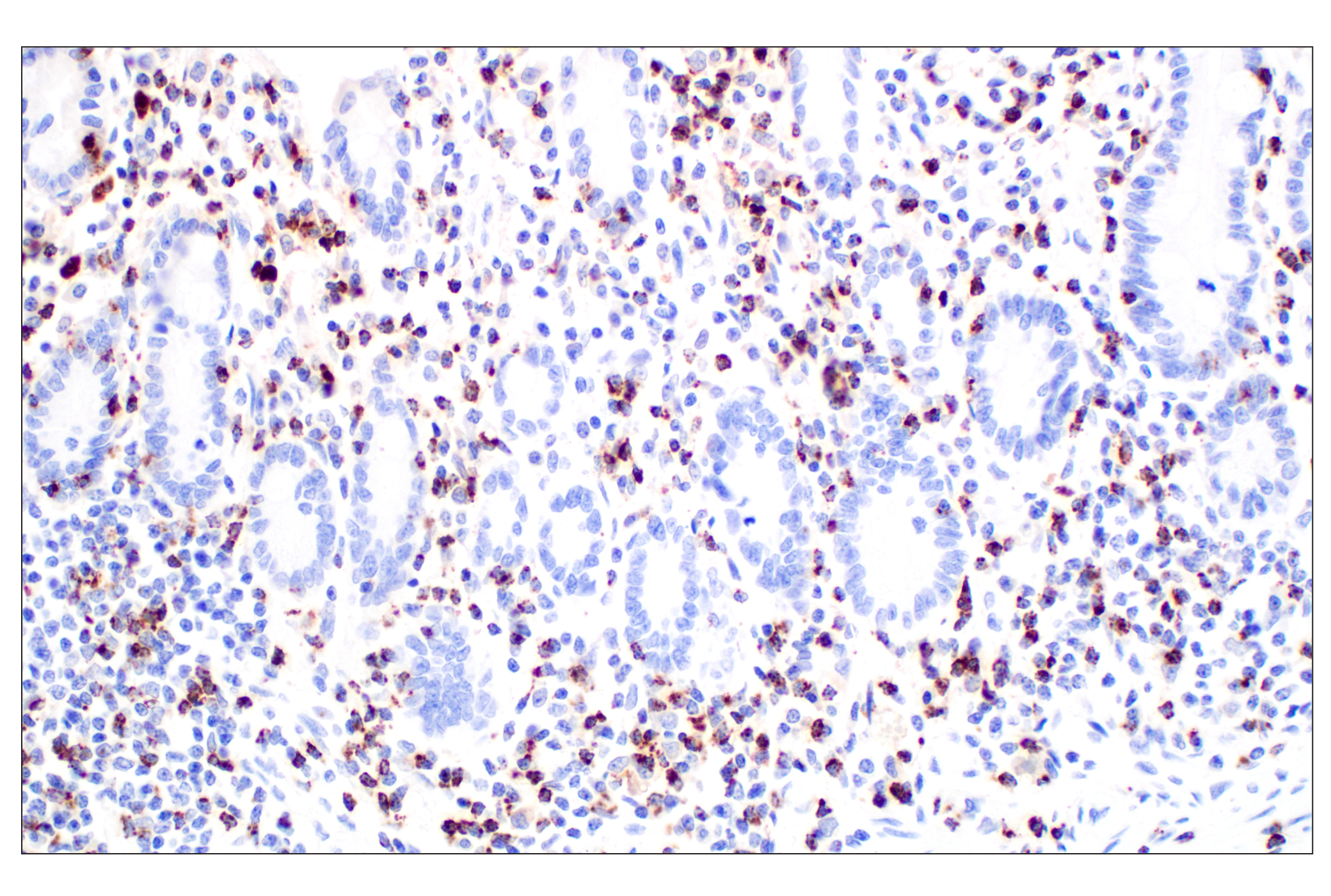 Immunohistochemistry Image 7: NKG7 (F4V5I) Rabbit mAb